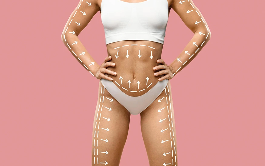 What Areas Can Be Treated with Vaser Liposuction?