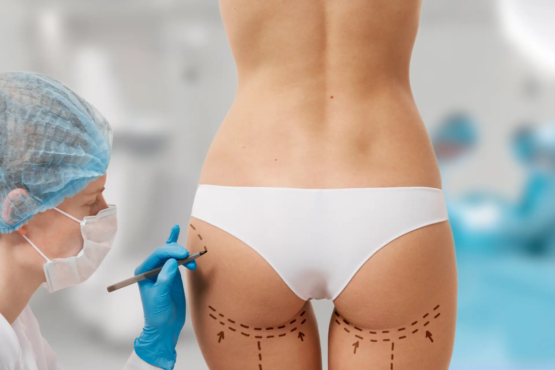 Your Guide To Body Sculpting In London