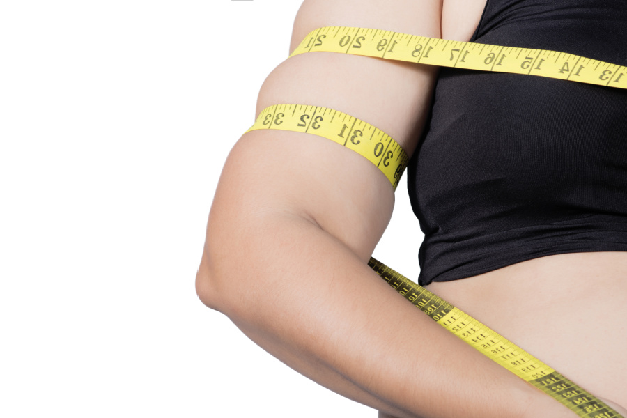 VASER Liposuction For Bingo Wings/Arms